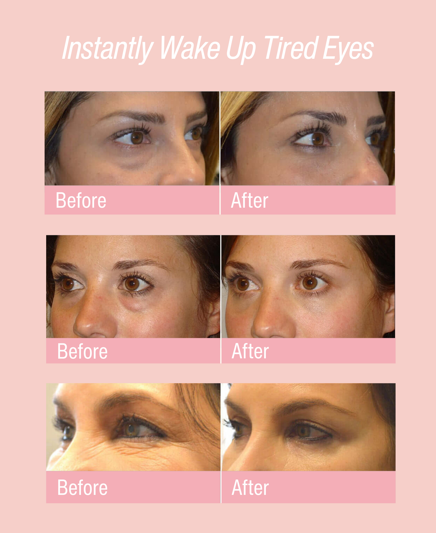 Freeze-Dried Collagen Eye Patches